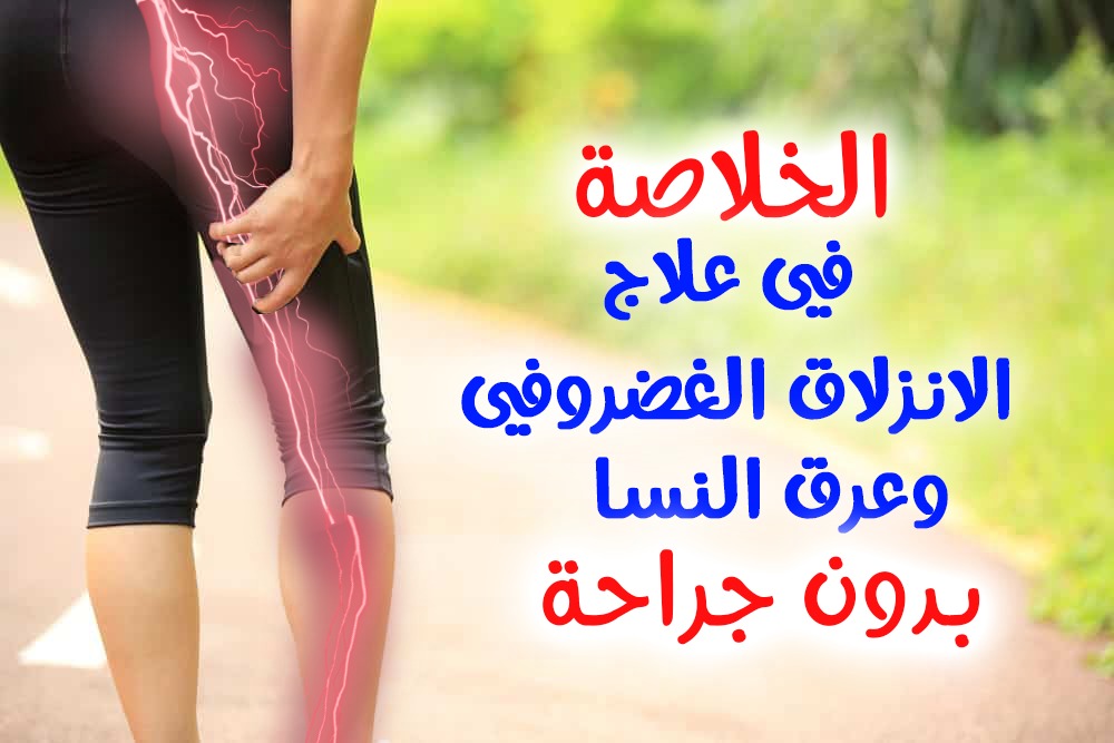 الخلاصة فى علاج الانزلاق الغضروفى وعرق النسا بدون جراحة/د.محمد حمادة